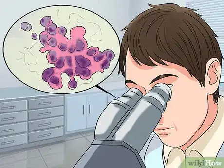 Image titled Screen for Lung Cancer Step 8