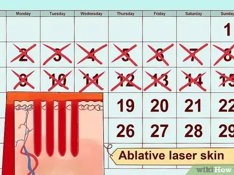Image titled Choose Laser Skin Resurfacing Step 10