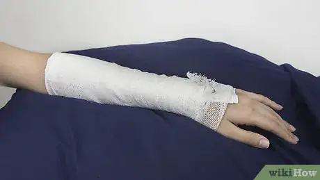 Image titled Strap an Elbow Step 12