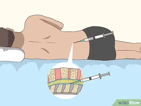 Image titled Diagnose ALS (Amyotrophic Lateral Sclerosis) Step 8