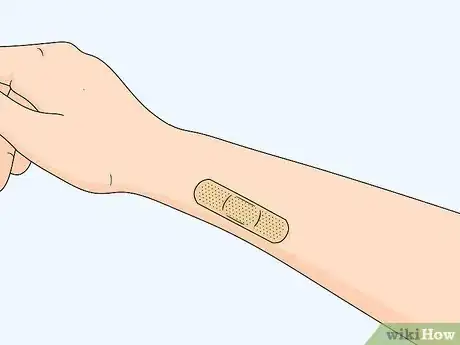 Image titled Treat Insect Bites in Toddlers Step 5