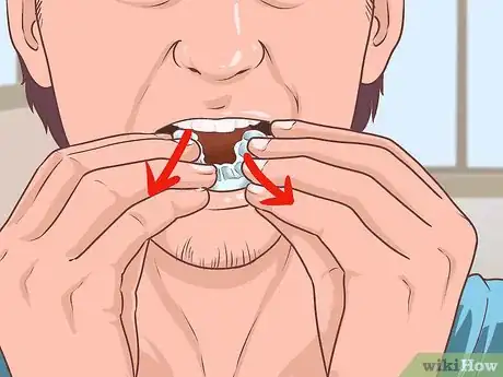 Image titled Use Prescription Gel to Whiten Teeth Step 5