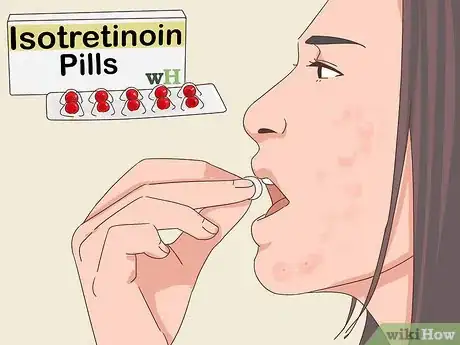 Image titled Treat Nodular Acne Step 2
