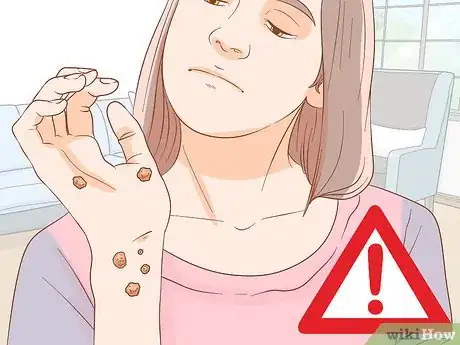 Image titled Test for HPV Step 1