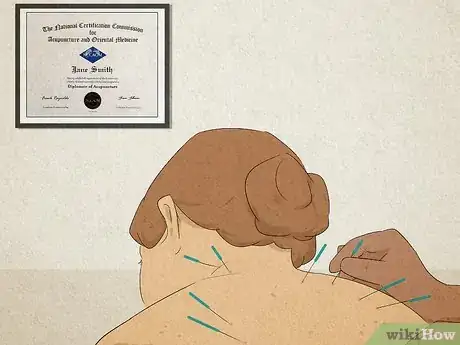 Image titled Find a Licensed Acupuncturist Step 14