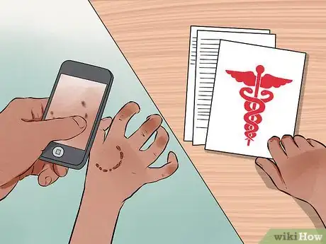 Image titled Take Action Against the Misuse of Police Dogs Step 1