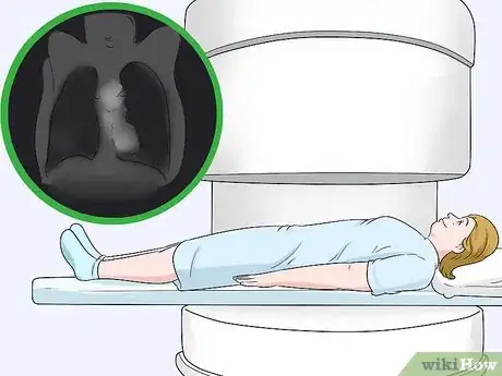 Image titled Diagnose Tuberous Sclerosis Step 8