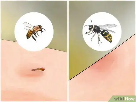Image titled Identify Insect Bites Step 4