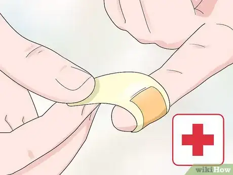 Image titled Prevent Psoriasis Step 12