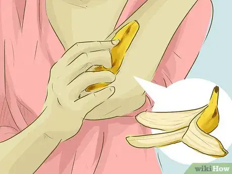 Image titled Stop Scratching Irritated Skin Step 3