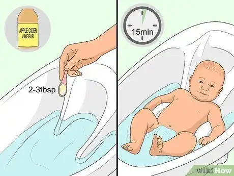 Image titled Relieve Diaper Rash Fast Step 12