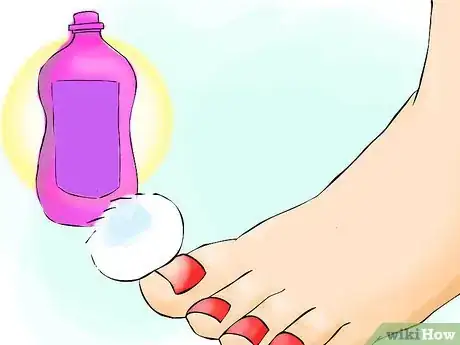 Image titled Get Perfect Feet for Summer Step 01