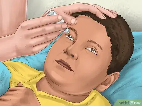 Image titled Administer Eye Drops in Children Step 22