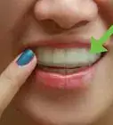 Make a Fake Retainer Out of Wax