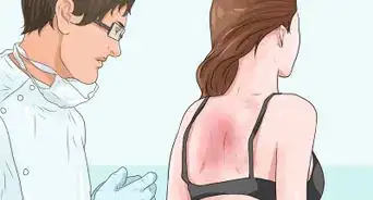 Treat Erythrodermic Psoriasis