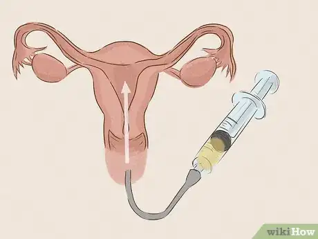 Image titled Treat Infertility Step 5
