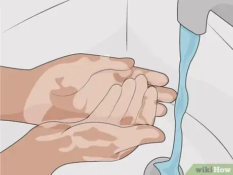 Image titled Prevent an Eye Infection Step 01