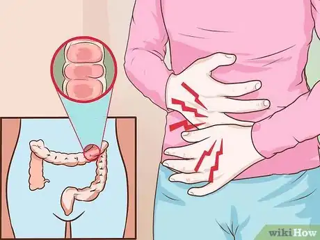 Image titled Cure Colitis Step 1