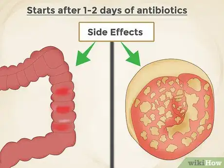Image titled Take Antibiotics with Probiotics Step 2