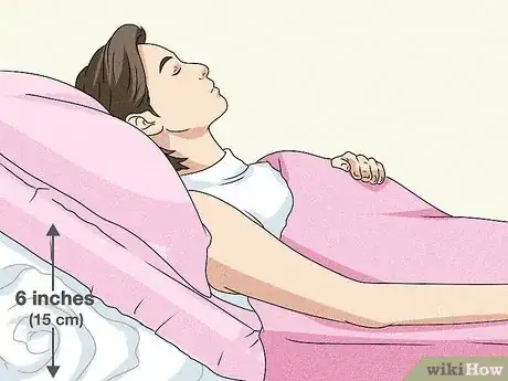 Image titled Treat Dyspepsia Step 6