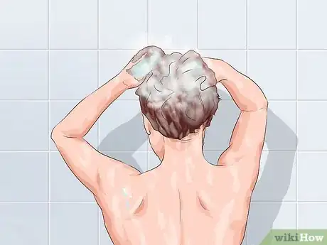 Image titled Care for a Hair Transplant Step 6