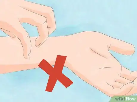 Image titled Care for Skin During Winter Step 12