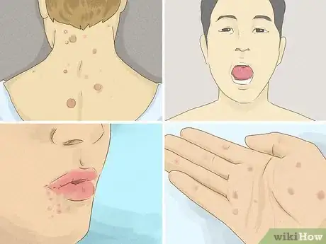 Image titled Prevent Nongenital STIs Step 1