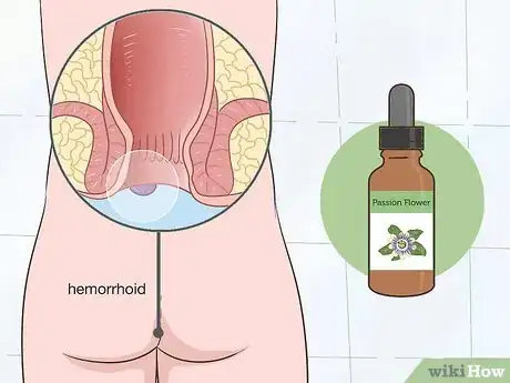 Image titled Use Passion Flower for Health Step 10