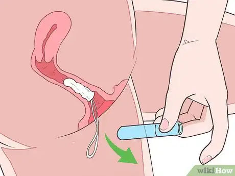 Image titled Insert a Tampon for the First Time Step 10