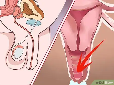 Image titled Diagnose Fanconi Anemia Step 8