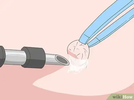 Image titled Care for Mature Skin Step 21