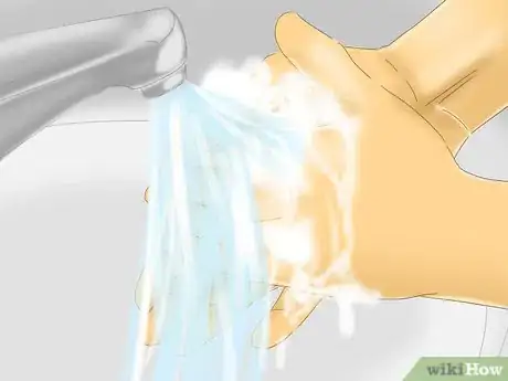 Image titled Care for Minor Abrasions and Scratches Step 1