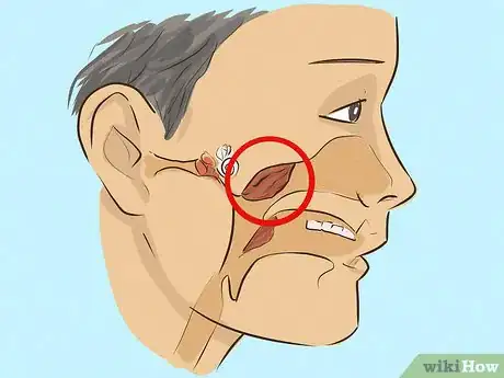 Image titled Drain Ear Fluid Step 18