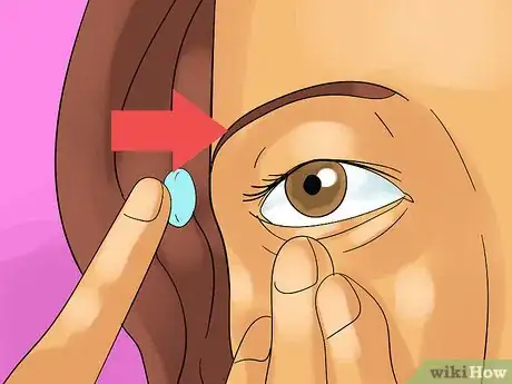 Image titled Deal With Hard Contacts Step 3