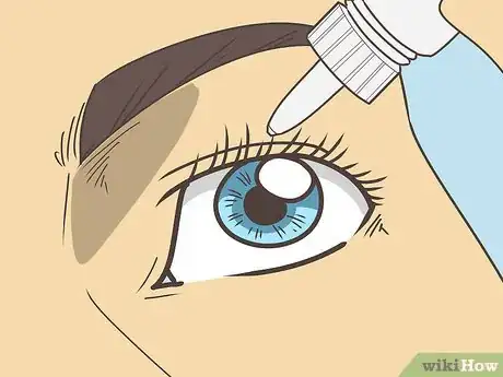 Image titled Treat Cataracts Step 6