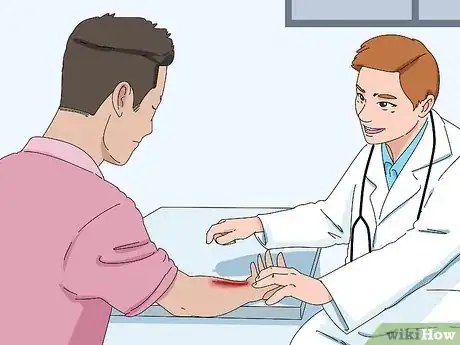 Image titled Prevent Milia Step 5