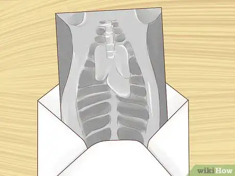 Image titled Diagnose and Treat Chlamydiosis in Cats Step 7