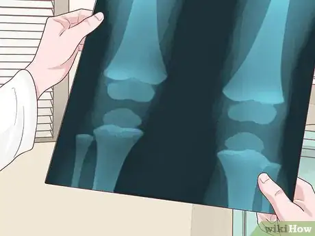Image titled Diagnose Low Bone Density in Kids Step 3