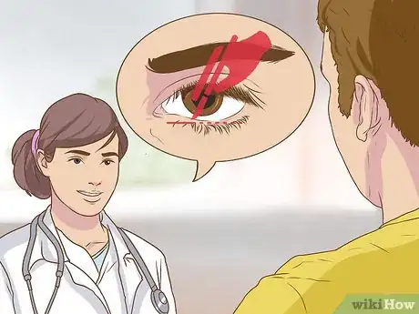 Image titled Diagnose Surfer's Eye Step 8