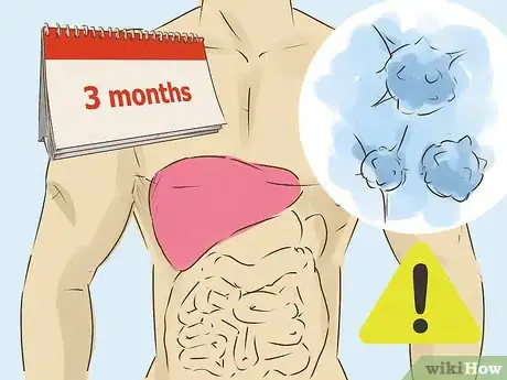 Image titled Help Someone Recover From a Liver Transplant Step 11