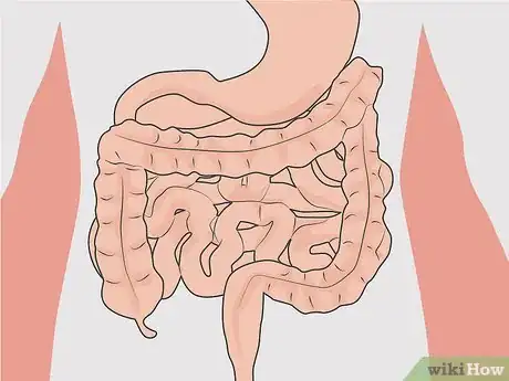 Image titled Treat Post Lyme Disease Syndrome Step 13