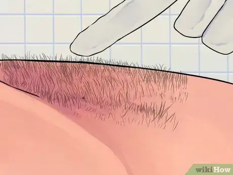 Image titled Do a Male Brazilian Wax Step 18