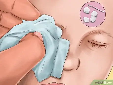 Image titled Administer Eye Drops in Children Step 19