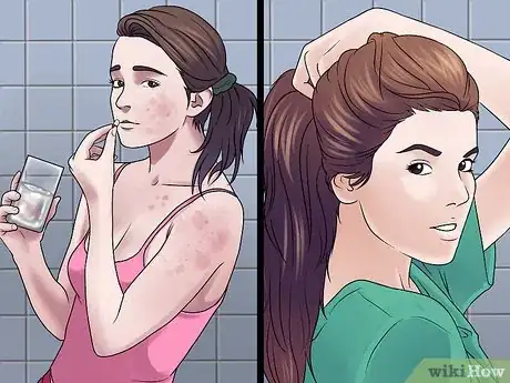 Image titled Cure Scarlet Fever Step 6