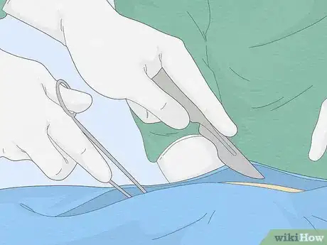 Image titled Treat Prostate Cancer with Androgen Deprivation Therapy Step 7