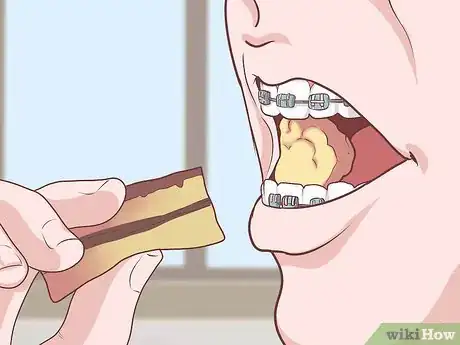 Image titled Cope With Braces As a Teenager Step 16