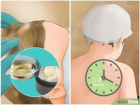 Image titled Get Rid of Lice With Orange Juice Step 10