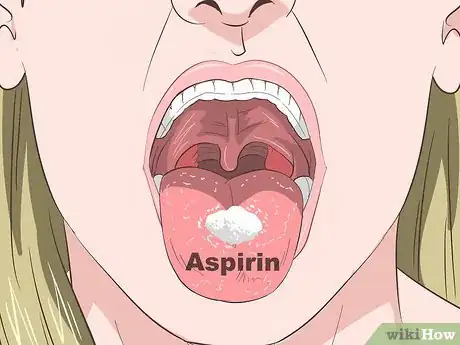 Image titled Treat Nstemi Step 3