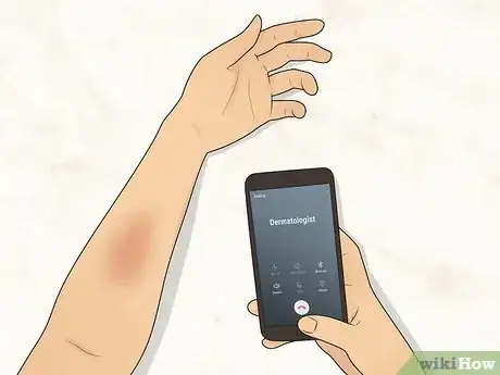 Image titled Avoid Irritation Caused by Natural Skin Care Products Step 10