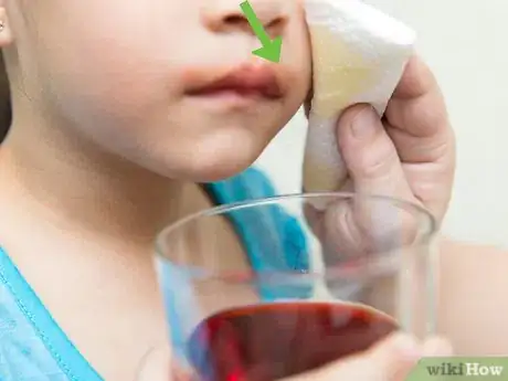 Image titled Remove Kool Aid from Skin Step 6